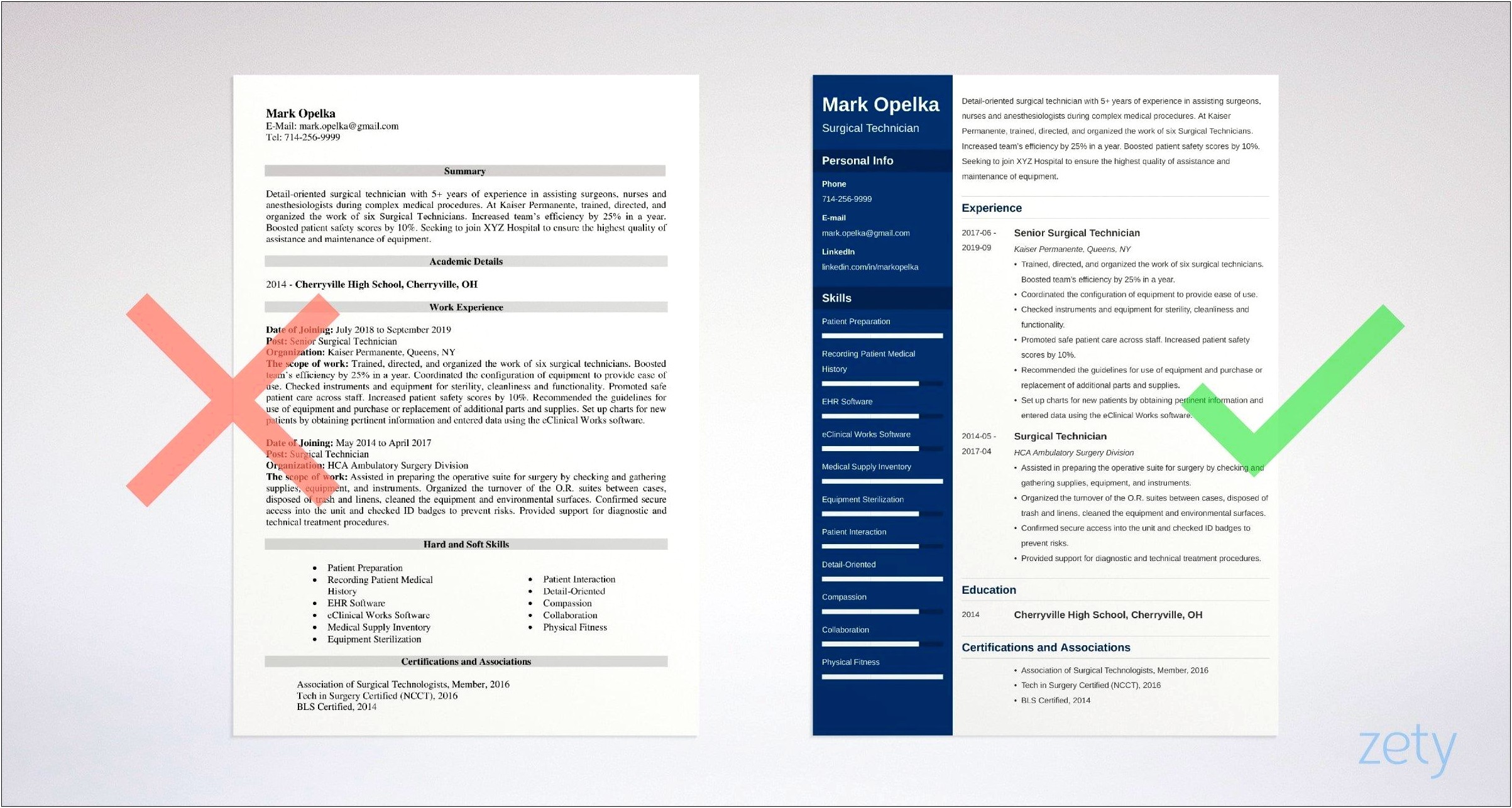 Entry Level Surgical Tech Resume Sample